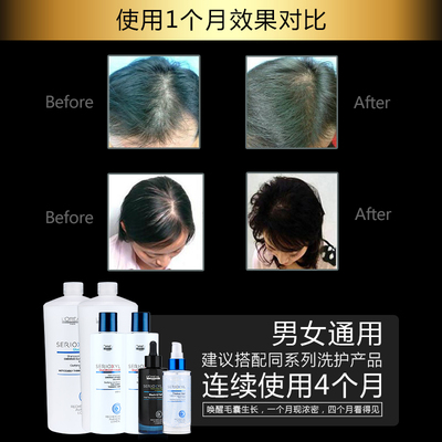 科技賦能防脫，歐萊雅芯基源洗護套裝 深入發芯，重塑強韌發絲