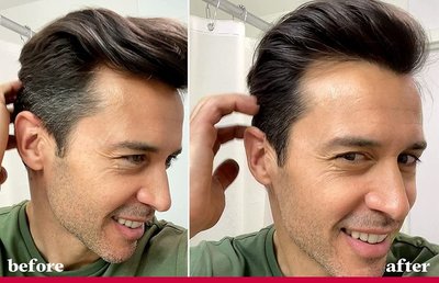 年紀(jì)輕輕就長白頭發(fā)？從沐浴用品到生活方式的全方位應(yīng)對指南